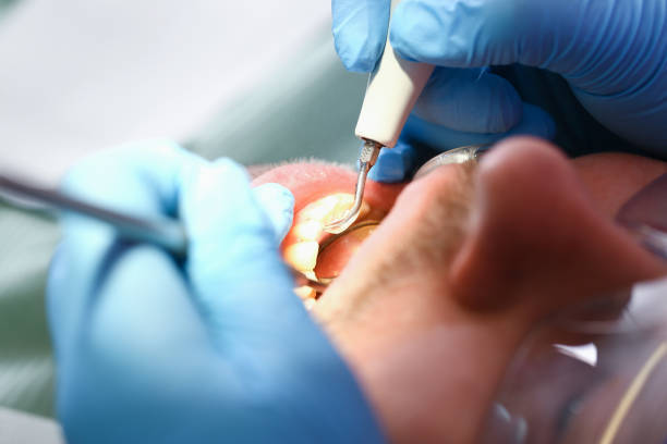Best Emergency Dental Services for Seniors in Bovina, TX